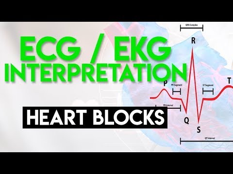 Heart Blocks Made Easy | ECG EKG Interpretation (Part 6)
