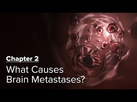 What Causes Brain Metastases? Chapter 2 — Brain Metastases: A Documentary