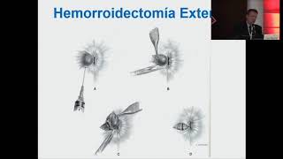 URGENCIAS PROCTOLÓGICAS EN CUIDADO PRIMARIO - Dr. CARLOS MARTÍNEZ