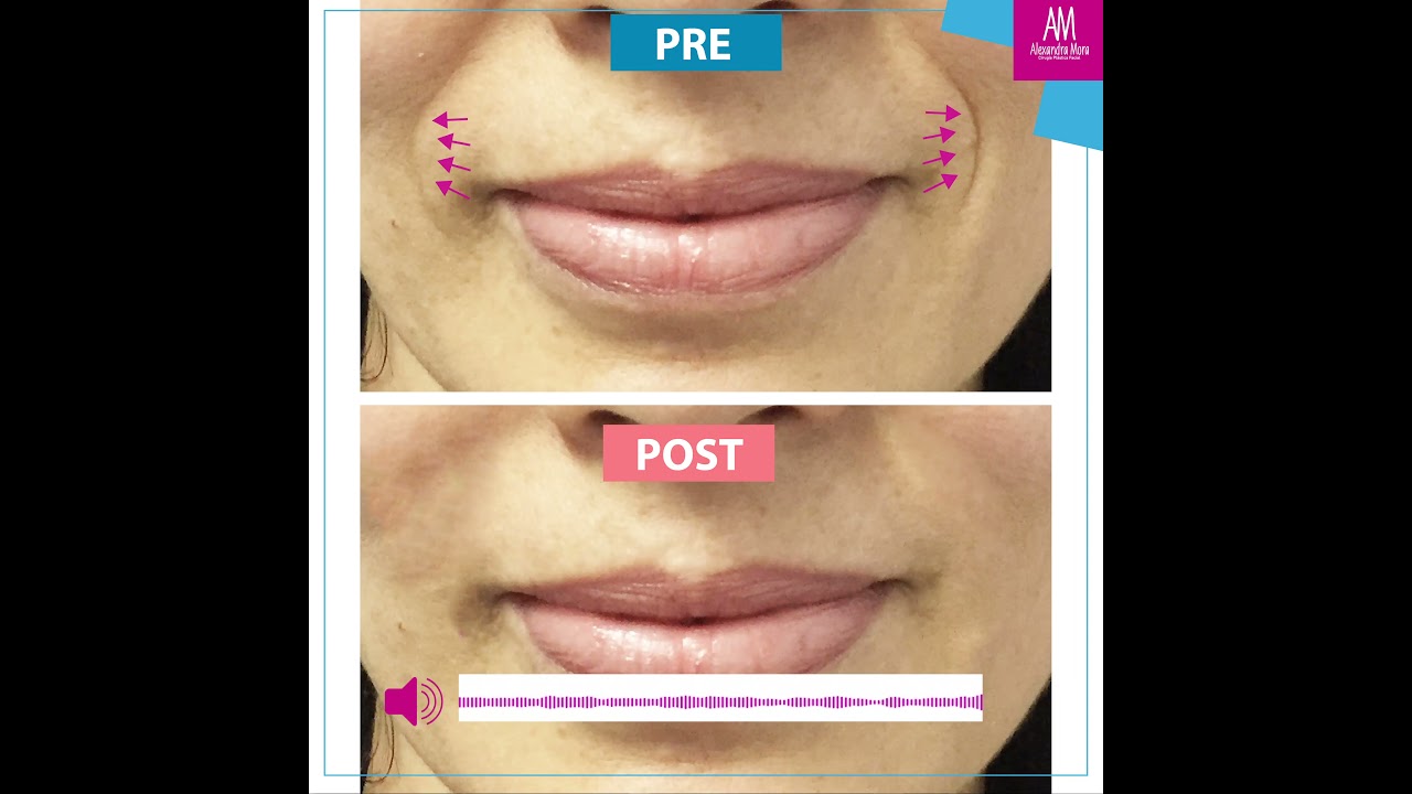 Alexandra Mora Hernandez-146