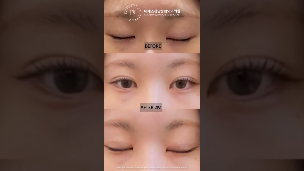 이에스 유튜브