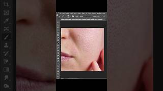 How to Repair Skin in Photoshop (Acne, Blemish & Texture Fix)
