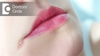 How to manage Angular Cheilitis? - Dr. Aniruddha KB