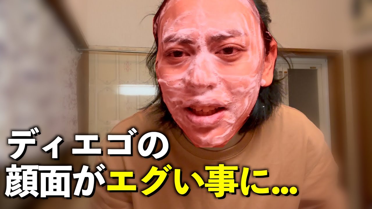 【話題】顔面に針を刺すダイソーの美容グッズがエグすぎた...