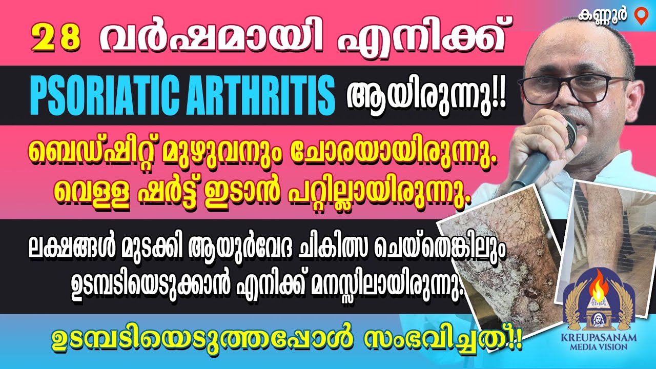 28 വർഷമായി എനിക്ക് PSORIATIC ARTHRITIS ആയിരുന്നു!! ബെഡ്ഷീറ്റ് മുഴുവനും ചോരയായിരുന്നു