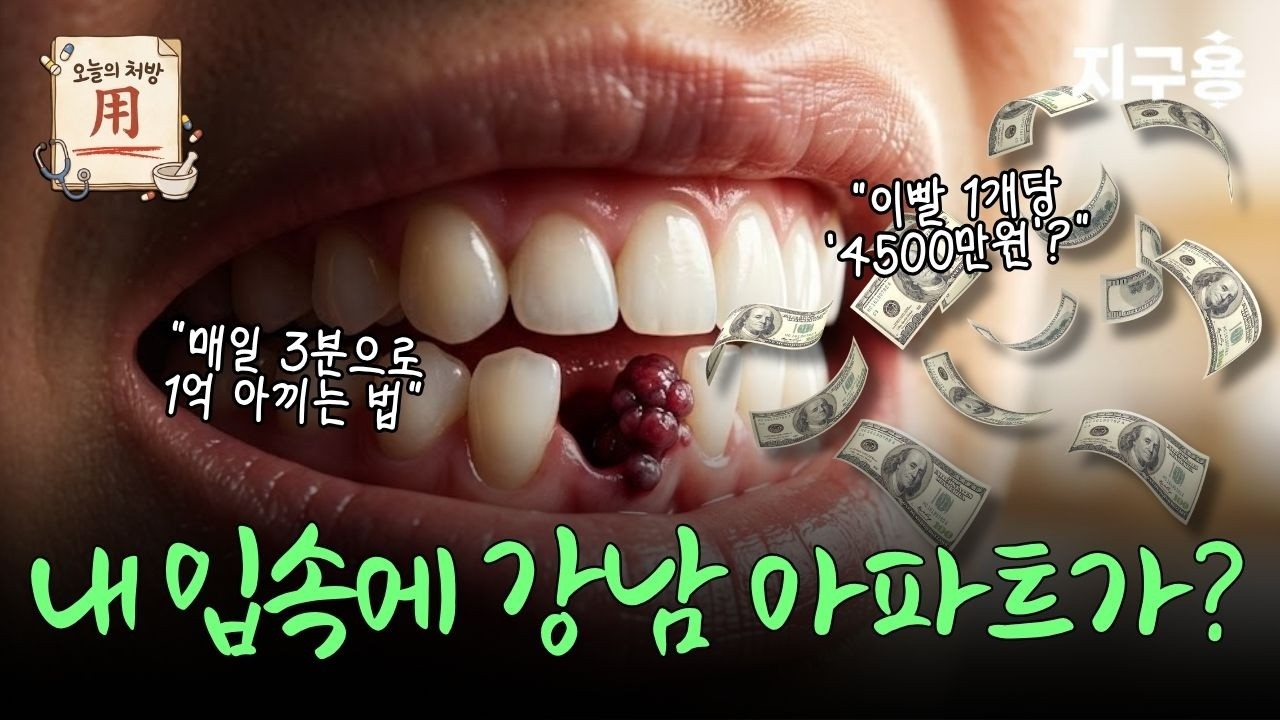 내 입속에 '강남 아파트'가? 치아 1개 4500만원, 역대급 가성비 건강 재테크