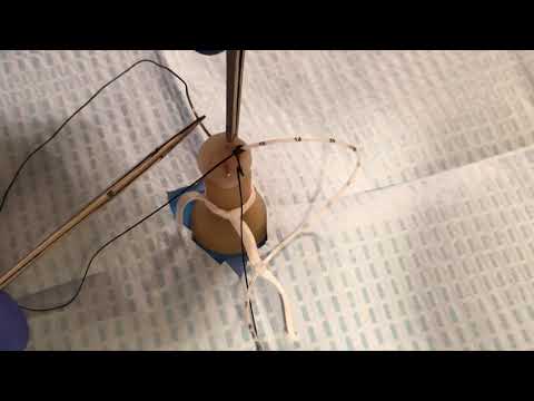 Suturing of an umbilical cord nicu smh 2