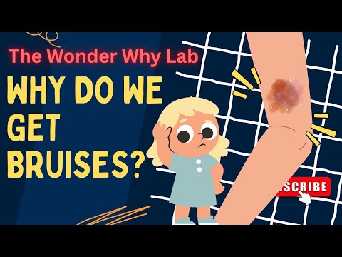 Science for Kids: Why Do We Get Bruises? | The Wonder Why Lab
