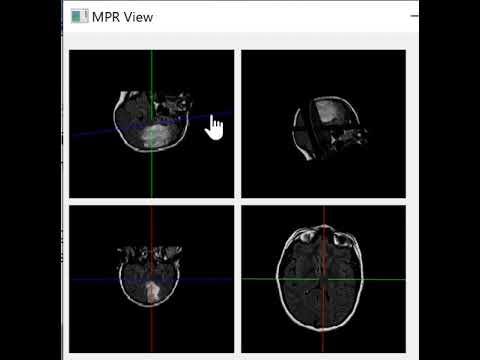 保健学科 MPR View For MS windows