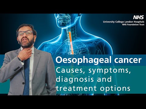 Oesophageal cancer | Causes, symptoms, diagnosis, and treatment options