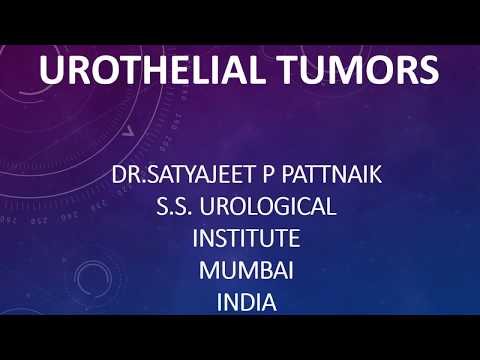 ETIOLOGY, DIAGNOSIS AND TREATMENT OF UROTHELIAL TUMORS