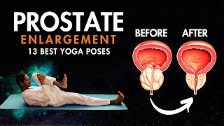 13 Best Yoga Exercises for Prostate Health | Natural Relief for Men #prostatecancer