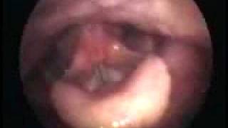 Flexible: vocal arpeggio in female