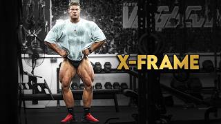 No More Excuses. Just Legs.