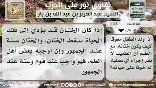 صورة 1128 - كيفية ختان المولود المعوق - نور على الدرب