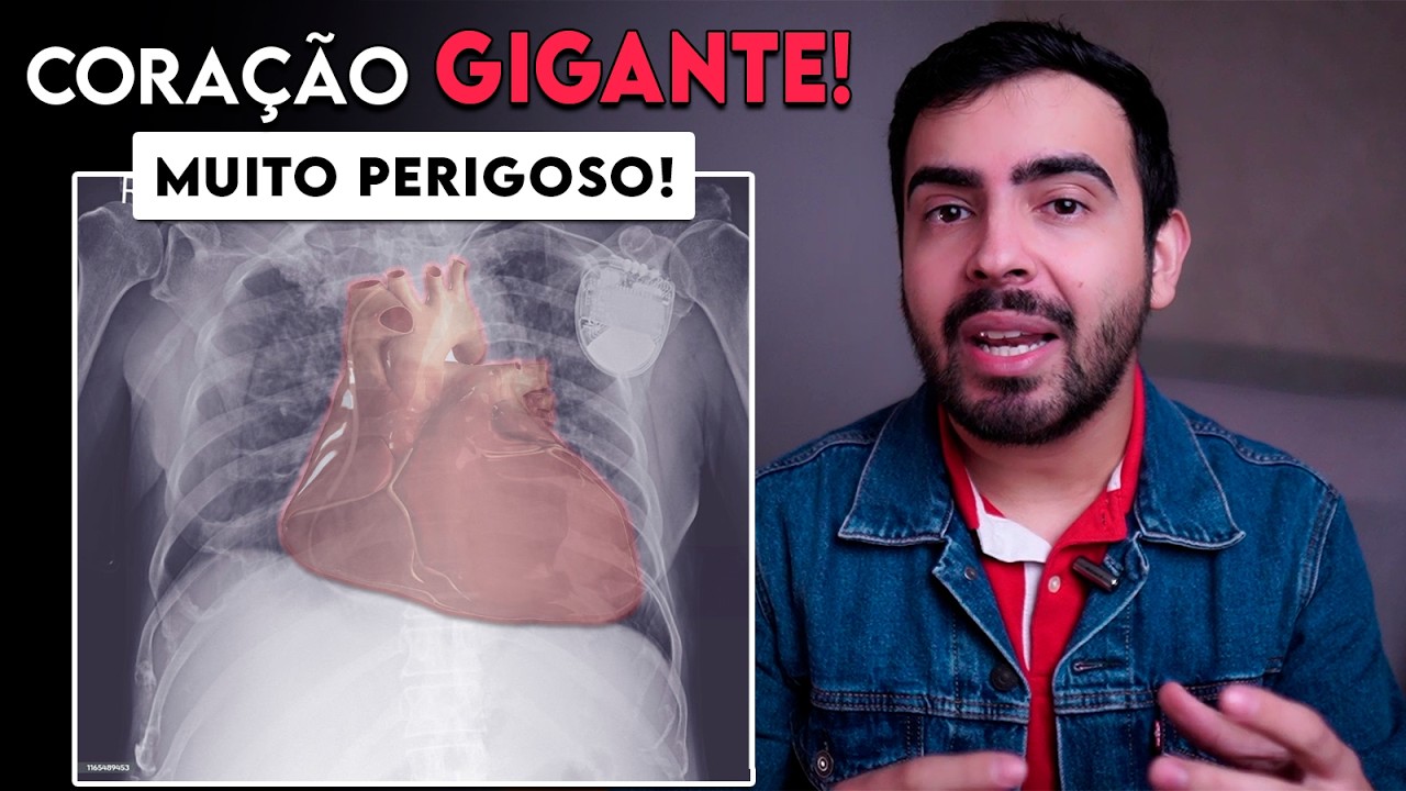 Como saber se o CORAÇÃO está GRANDE? - SINAIS DE CORAÇÃO GRANDE (cardiomegalia)