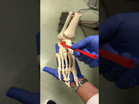 Midtarsal Joint Oblique Axis