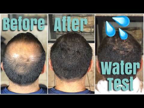 Hair Building Fibres Hair Fibers Latest Price Manufacturers Suppliers