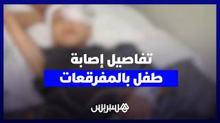 أخت الطفل ضحية مفرقعات عاشوراء تروي تفاصيل الحادث وتداعياته الصحية والنفسية thumbnail