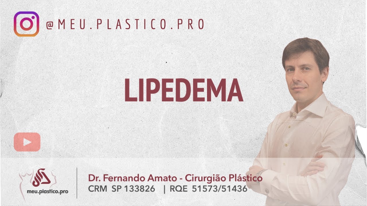 Lipedema - Dr Fernando Amato