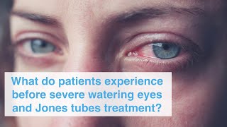 What do patients experience before severe watering eyes and Jones tubes treatment?