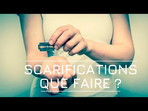 Face aux scarifications d'un ado, que faire ? Avec David Le Breton