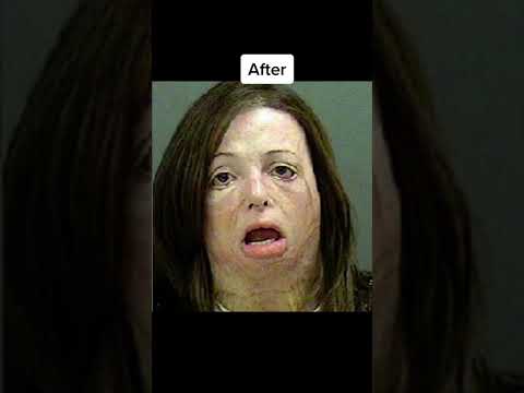 People before and after addiction #shorts