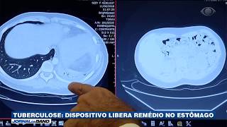 Miniatura do vídeo