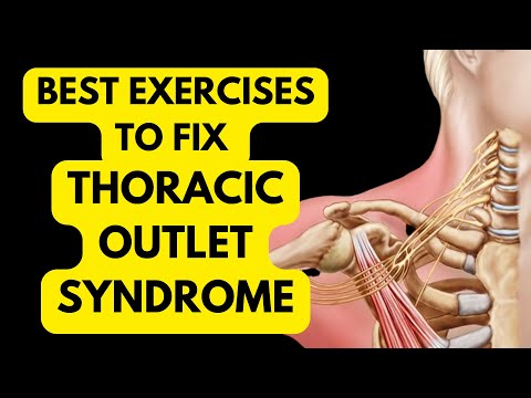 The Game-Changing Approach To Thoracic Outlet Syndrome (you’ve never tried this)
