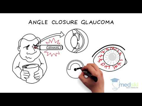 Ophthalmology – Red Eye: By Stephanie Baxter M.D.