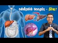 How to REVERSE fatty liver naturally (Tamil) | Dr Pal