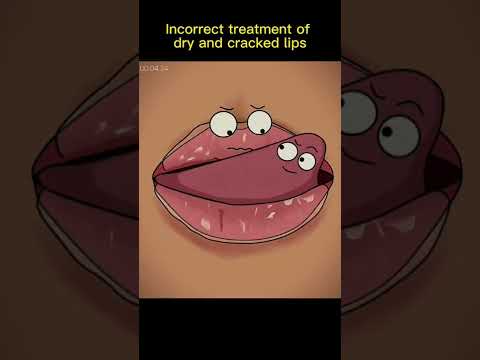 Dry And Cracked lips