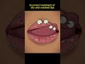 Dry And Cracked lips