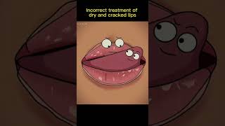 Dry And Cracked lips