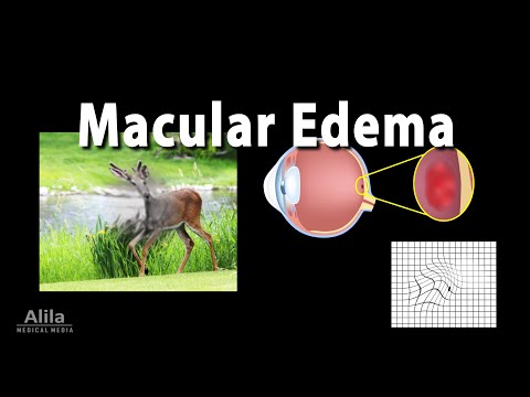 Vision Anatomy and Physiology Animation