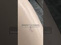 Removing Ink From Leather