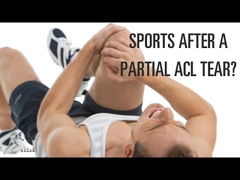 Can I play sports after a partial ACL tear?