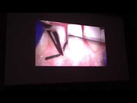 MixFightDentistry in Czech Republic.