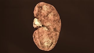 A Dad Didn&#39;t Brush His Teeth For 40 Days. This Is What Happened To His Kidneys.