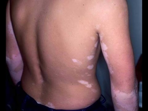 Emozionanti rimedi popolari per gli uomini e le donne Sesso penis