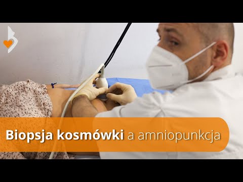 Badania prenatalne #18 - Biopsja kosmówki a amniopunkcja