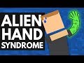 This Strange Syndrome Takes Control Of Your Body