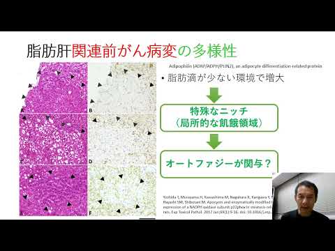 シンプルなクラスター解析を用いた微小病変のオートファジー解析の提案