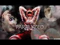 Paralyzed AMV SAD
