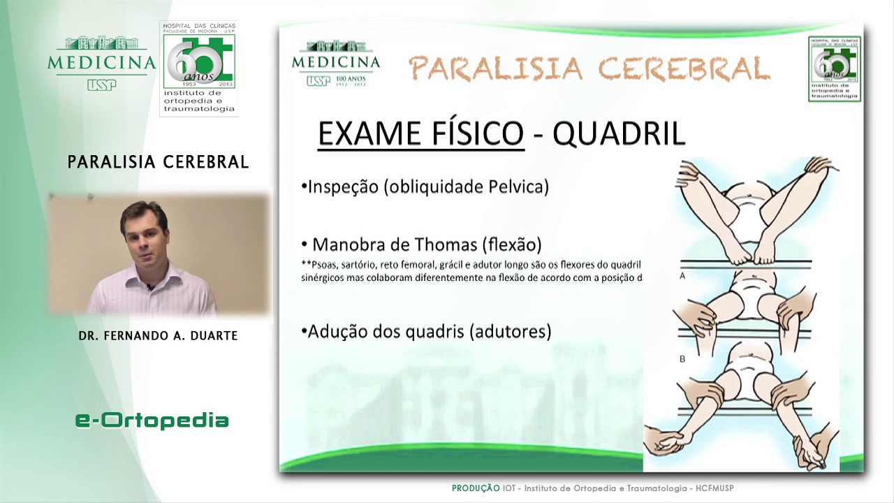 Paralisia Cerebral - Dr. Fernando A. Duarte