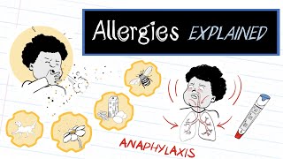 What are Allergies (HealthSketch)