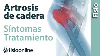 Artrosis o desgaste de cadera - Qué es, causas, síntomas y tratamiento