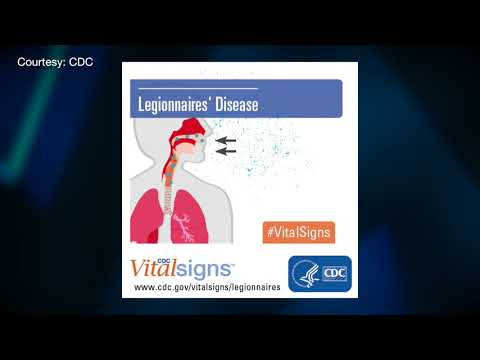 Legionnaires’ Disease