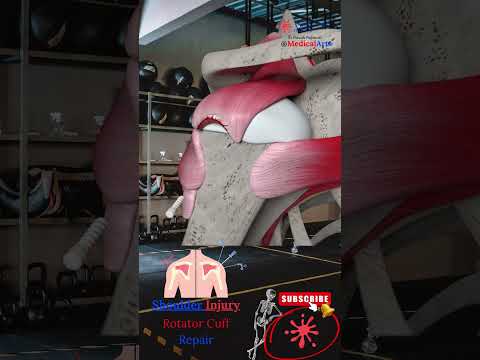 Rotator cuff injury - Rotator cuff tear treatments