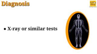 Heat Exhaustion and Heat Stroke